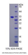 Human Leucyl tRNA Synthetase (LARS) Protein