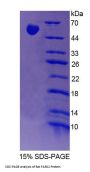 Rat Phenylalanyl tRNA Synthetase 2, Mitochondrial (FARS2) Protein