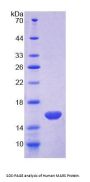 Human Methionyl tRNA Synthetase (MARS) Protein