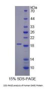 Human Aspartyl tRNA Synthetase (DARS) Protein