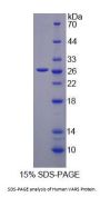 Human Valyl tRNA Synthetase (VARS) Protein