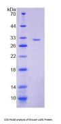 Mouse Valyl tRNA Synthetase (VARS) Protein