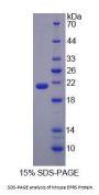 Mouse Glutamyl Prolyl tRNA Synthetase (EPRS) Protein