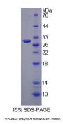 Human Membrane Protein, Palmitoylated 3 (MPP3) Protein