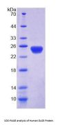 Human Discs, Large Homolog 5 (DLG5) Protein