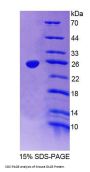 Mouse Discs, Large Homolog 5 (DLG5) Protein