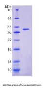 Human Arachidonate-12-Lipoxygenase, 12R Type (ALOX12B) Protein