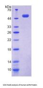 Human Acid Phosphatase 6, Lysophosphatidic (ACP6) Protein