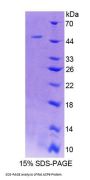 Rat Acid Phosphatase 6, Lysophosphatidic (ACP6) Protein