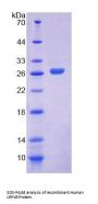 Human Low Density Lipoprotein Receptor Related Protein 1B (LRP1B) Protein