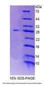 Mouse Low Density Lipoprotein Receptor Related Protein 1B (LRP1B) Protein