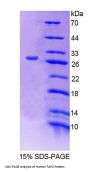 Human Antigen Peptide Transporter 2 (TAP2) Protein