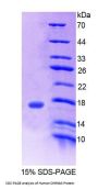 Human Cholinergic Receptor, Nicotinic, Beta 3 (CHRNb3) Protein