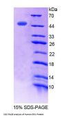 Human Exoribonuclease 1 (ERI1) Protein