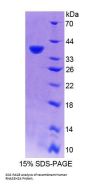 Human Ribonuclease H2 Subunit A (RNASEH2A) Protein