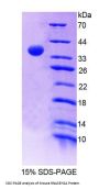 Mouse Ribonuclease H2 Subunit A (RNASEH2A) Protein