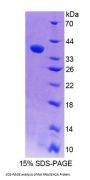 Rat Ribonuclease H2 Subunit A (RNASEH2A) Protein