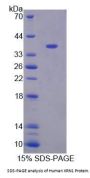 Human 5'-3'Exoribonuclease 1 (XRN1) Protein
