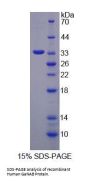 Human Glucosidase Alpha, Neutral AB (GaNAB) Protein