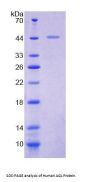Human Glycogen Debranching Enzyme (AGL) Protein