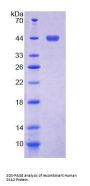 Human Sjogren Syndrome Antigen A2 (SSA2) Protein