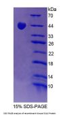 Mouse Sjogren Syndrome Antigen A2 (SSA2) Protein
