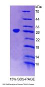Human E3 Ubiquitin-Protein Ligase TRIM21 (TRIM21) Protein