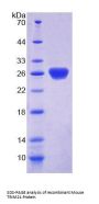 Mouse E3 Ubiquitin-Protein Ligase TRIM21 (TRIM21) Protein