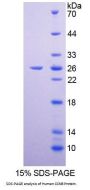 Human Cyclin B (CCNB) Protein