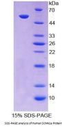 Human Amiloride Sensitive Sodium Channel Subunit Alpha (SCNN1a) Protein
