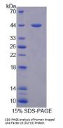 Human Krueppel-Like Factor 15 (KLF15) Protein