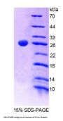 Human Myosin-11 (MYH11) Protein