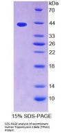 Human Tropomyosin 2 Beta (TPM2) Protein