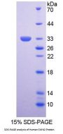 Human Survival Of Motor Neuron 2, Centromeric (SMN2) Protein