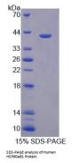 Human Heat Shock Protein 90 kDa Alpha B1 (HSP90aB1) Protein