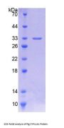 Pig Cytochrome P450 11A1 (CYP11A1) Protein