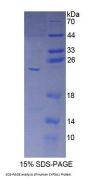 Human Cytochrome P450 5A1 (CYP5A1) Protein