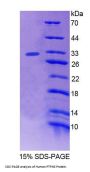 Human Protein Tyrosine Phosphatase, Non Receptor Type 3 (PTPN3) Protein