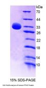 Human Protein Tyrosine Phosphatase, Non Receptor Type 7 (PTPN7) Protein