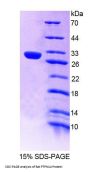 Rat Protein Tyrosine Phosphatase, Non Receptor Type 14 (PTPN14) Protein
