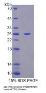 Human Protein Tyrosine Phosphatase, Non Receptor Type 21 (PTPN21) Protein