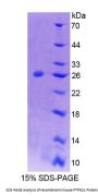 Mouse Protein Tyrosine Phosphatase, Non Receptor Type 21 (PTPN21) Protein