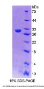 Human Protein Tyrosine Phosphatase, Non Receptor Type 22 (PTPN22) Protein