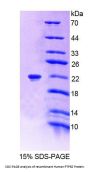 Human Protein Tyrosine Phosphatase Receptor Type Z (PTPRZ) Protein