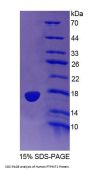 Human Protein Tyrosine Phosphatase, Mitochondrial 1 (PTPMT1) Protein