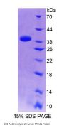 Human Protein Tyrosine Phosphatase F Interacting Protein 1 (PPFIA1) Protein