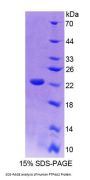 Human Protein Tyrosine Phosphatase Type IVA 2 (PTP4A2) Protein