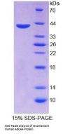 Human Retinal-Specific ATP-Binding Cassette Transporter (ABCA4) Protein