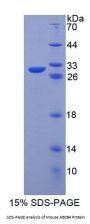 Mouse ATP Binding Cassette Transporter B4 (ABCB4) Protein
