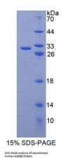 Human ATP-Binding Cassette Sub-Family B Member 6 (ABCB6) Protein